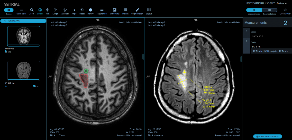 a screenshot of mediri's web-based DICOM viewer for medical image analysis in clincial studies with a brain MR image laoded